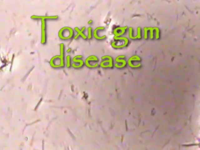Deadly Bacteria thumbnail