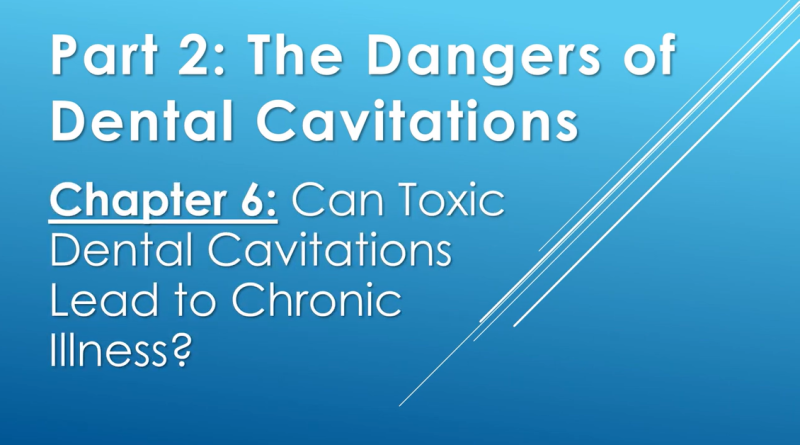 Part 2. Chapter 6: The Dangers Of Dental Cavitations Video Thumbnail